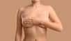 Augmenter la taille de sa poitrine, lorsqu'elle est jugée insuffisante ou qu'elle est asymétrique, est le rêve de nombreuses femmes ! La chirurgie moderne l'a rendu possible avec l'introduction sur le marché des premières prothèses en gel de silicone mises au point, au début des années 1960, par les docteurs Cronin et Gerow. Si certaines prothèses ont depuis fait scandale, ces interventions restent courantes et continuent d'évoluer pour plus de sécurité. Un point s'impose sur les avancées et les précautions en 2025.